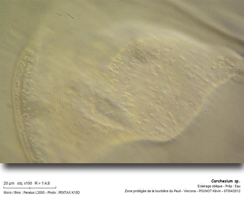 Carchesium sp. #26396