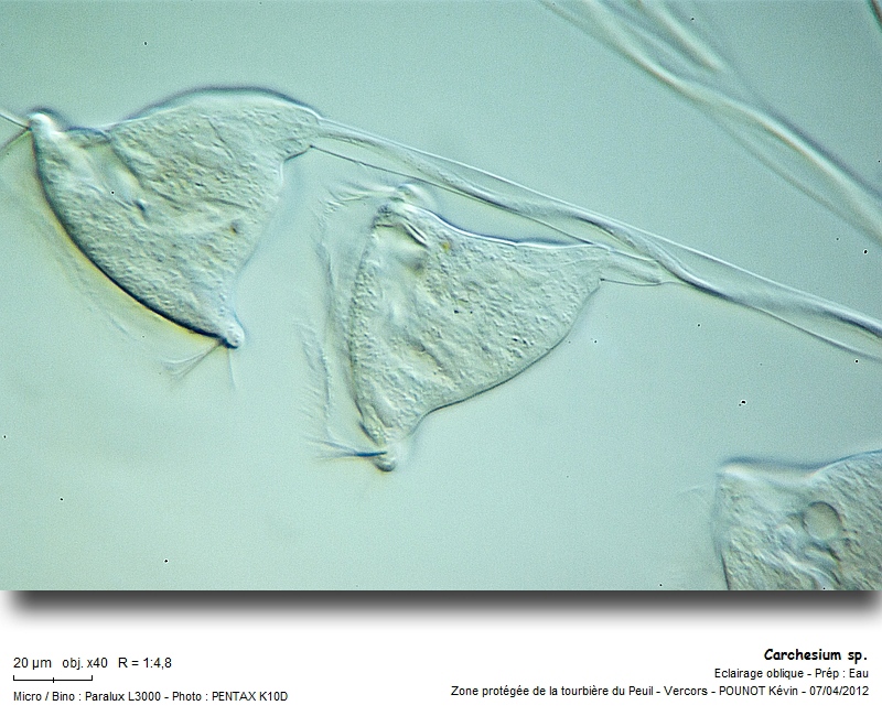 Carchesium sp. #26394