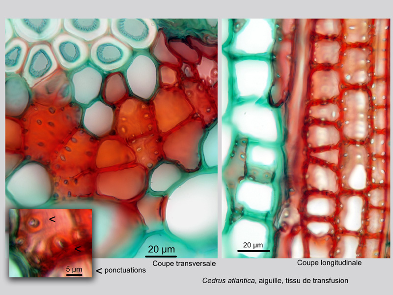Cedrus atlantica, histologie. #19754