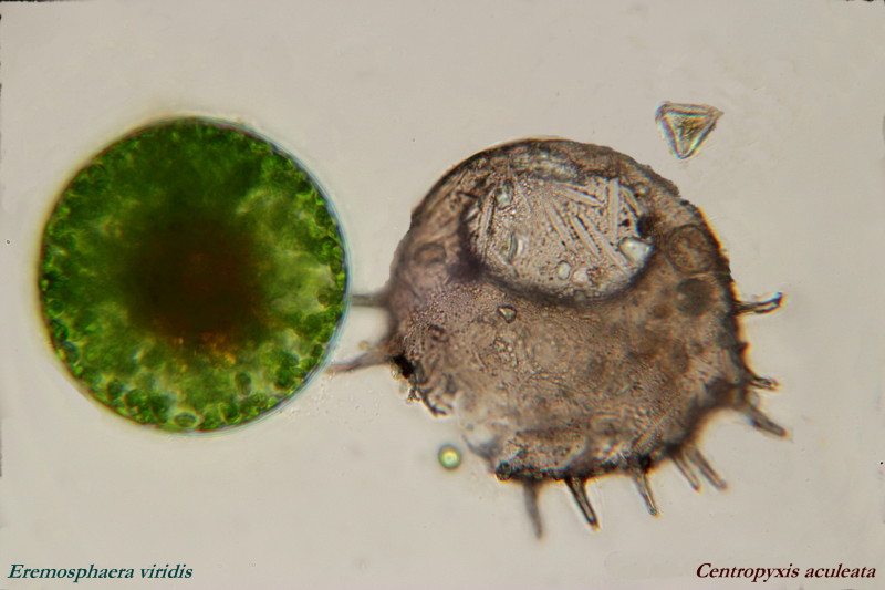 Centropyxis aculeata #34062