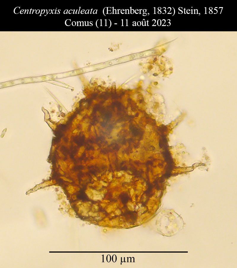 Centropyxis aculeata #77171