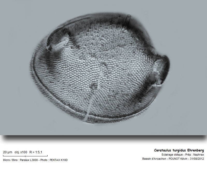 Cerataulus turgidus Ehrenberg #28078