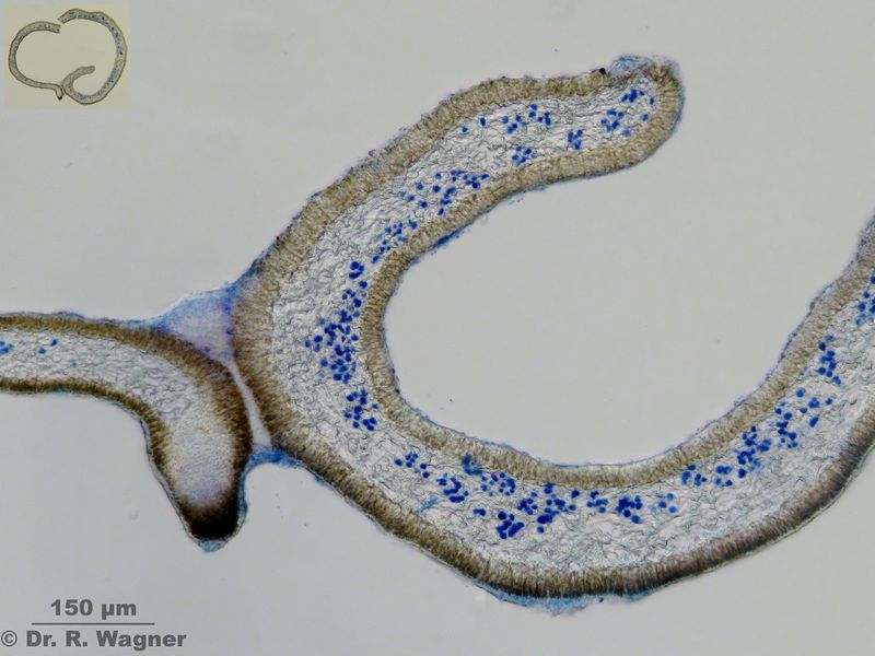 Cetraria cucullata #23141