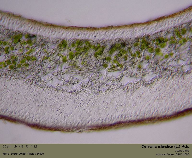 Cetraria islandica (L.) Ach. #1585