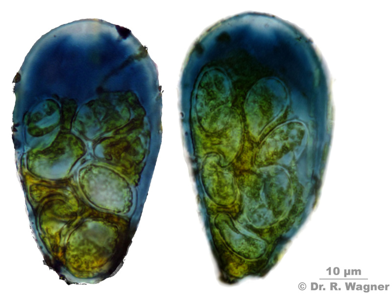 Cetrelia monachorum #14085