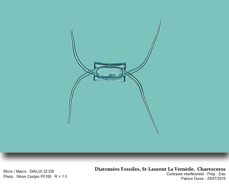 Chaetoceros #18775