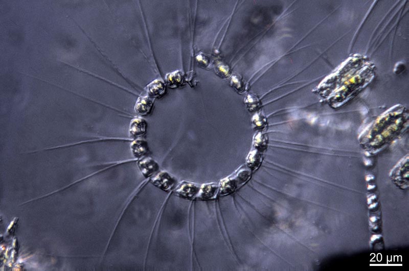 Chaetoceros curvisetus Cleve #36958