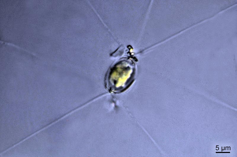 Chaetoceros densus (Cleve) #36952