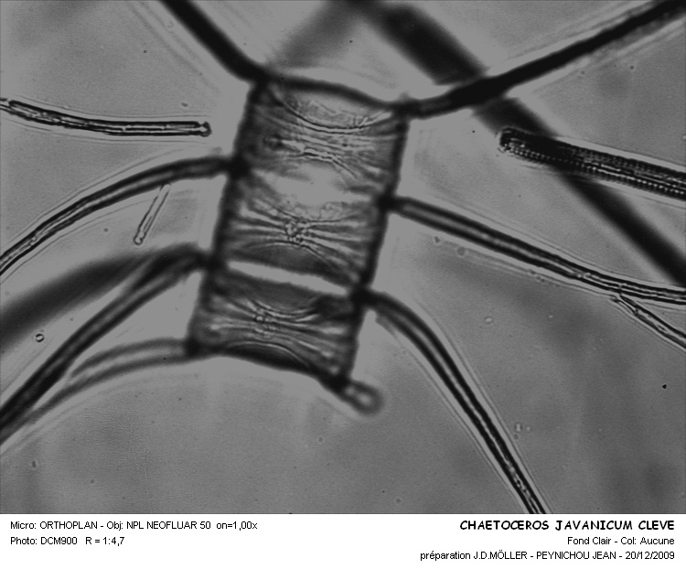 CHAETOCEROS JAVANICUM Cleve. #32232