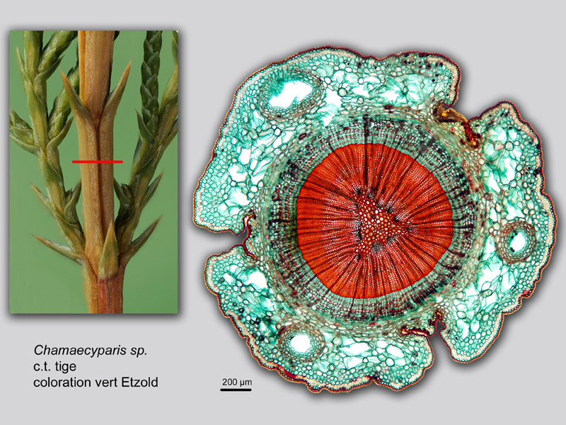 Chamaecyparis sp., histologie. #19940