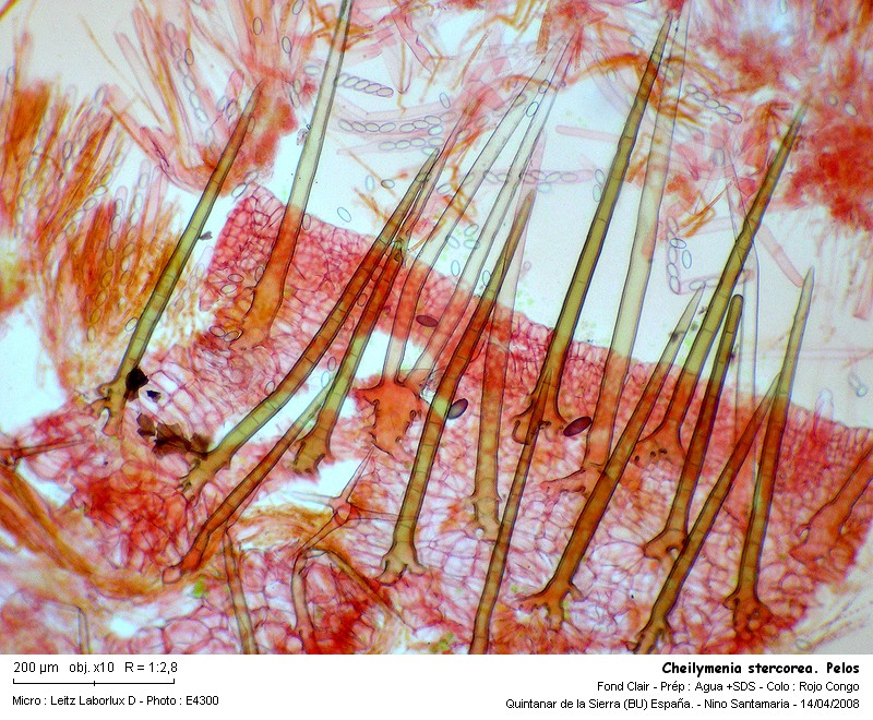 Cheilymenia stercorea (Pers.) Boud. #3398