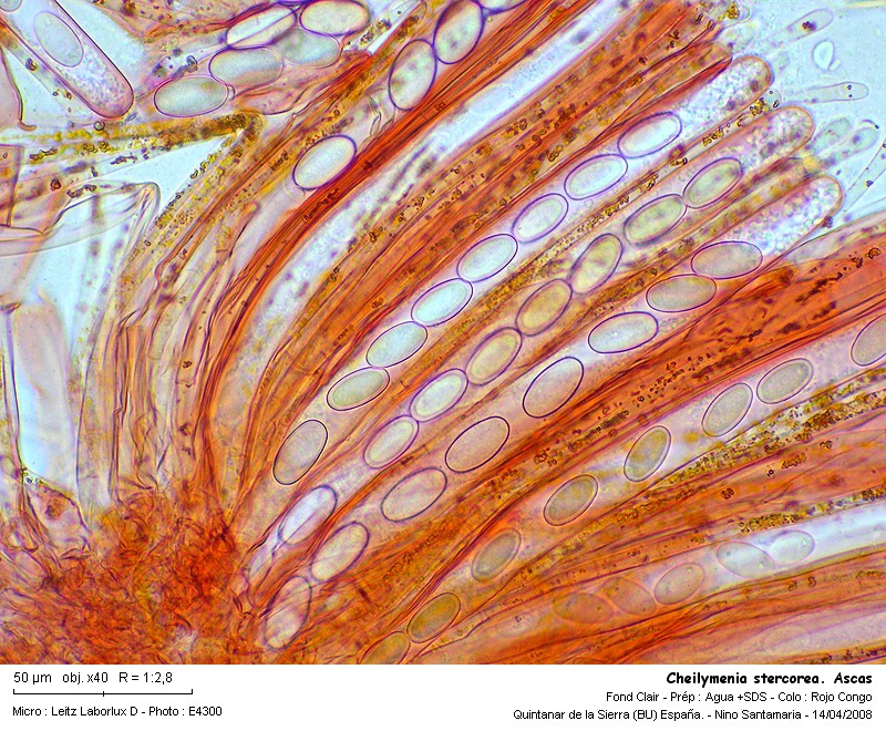 Cheilymenia stercorea (Pers.) Boud. #3400