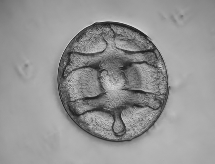 Cheloniodiscus ananinensis Pantocsek #34784
