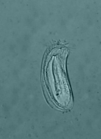 Chilodonella sp #37129