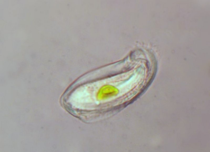Chilodonella sp #37124