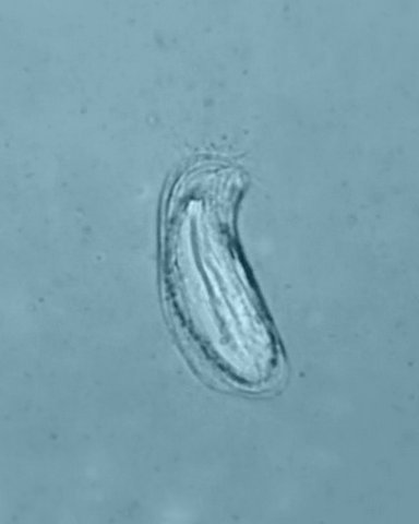 Chilodonella sp #37128