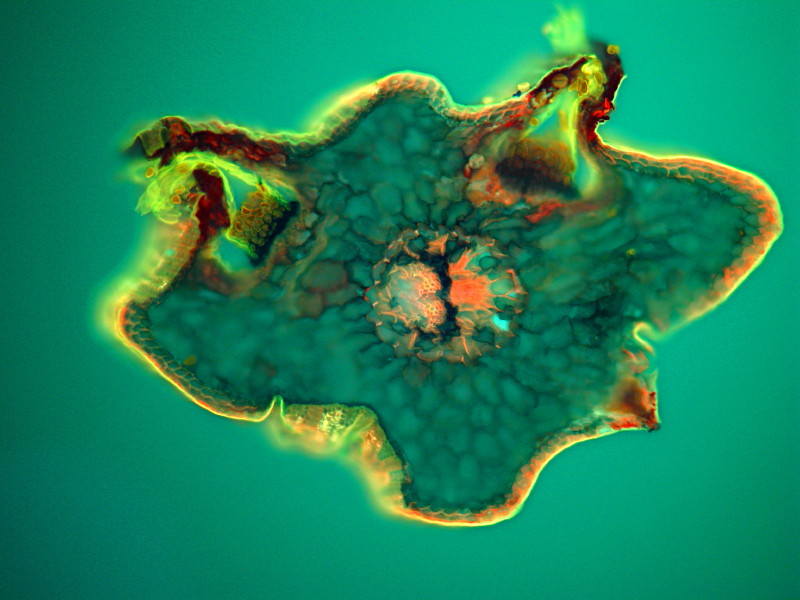 Chrysomyxa rhododendri et écidiospores - Epifluorescence #5540