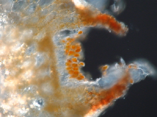 Chrysomyxa rhododendri et ecidiospores #5517
