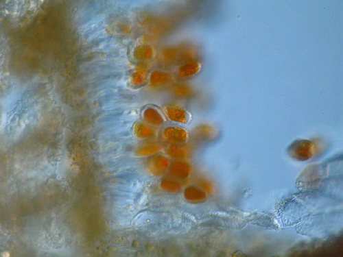 Chrysomyxa rhododendri et ecidiospores #5518