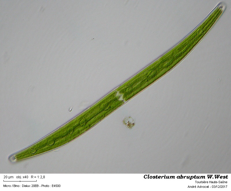 Closterium abruptum W.West #52833
