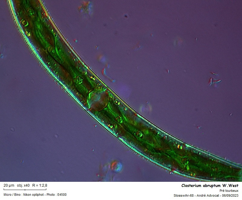 Closterium abruptum W.West #84489