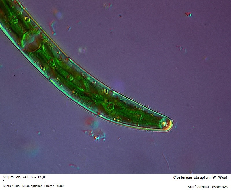Closterium abruptum W.West #84490