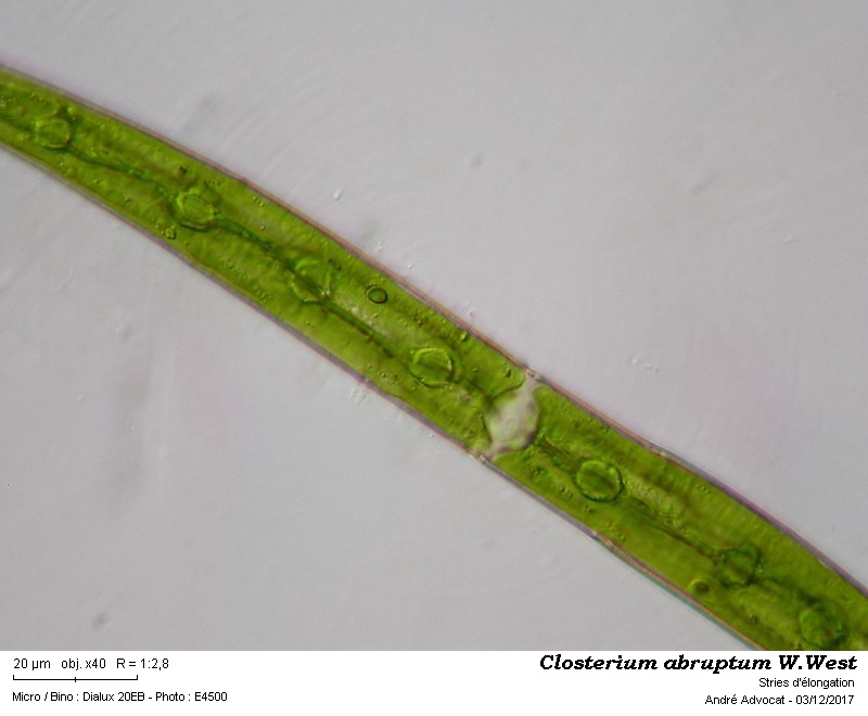 Closterium abruptum W.West #52835