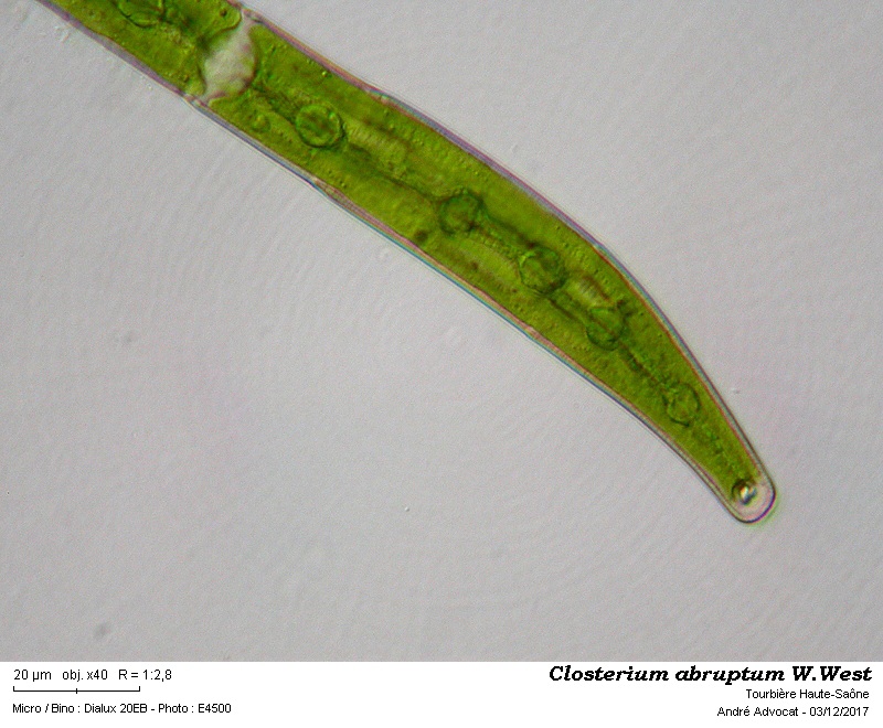 Closterium abruptum W.West #52834