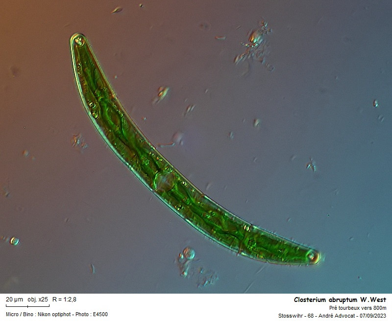 Closterium abruptum W.West #84488