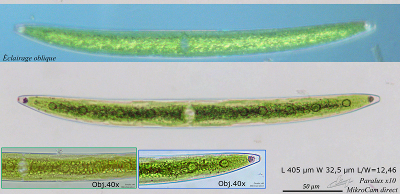 Closterium acerosum #65480