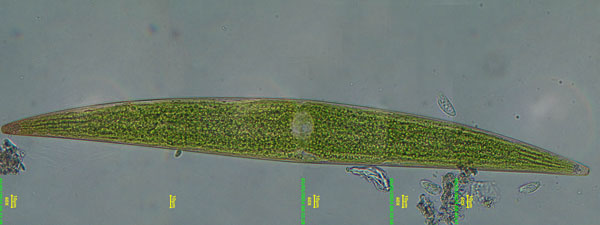 Closterium acerosum #81703