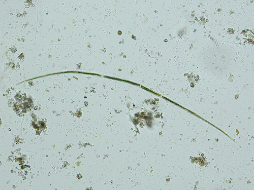 Closterium aciculare T. West, 1860 #47924