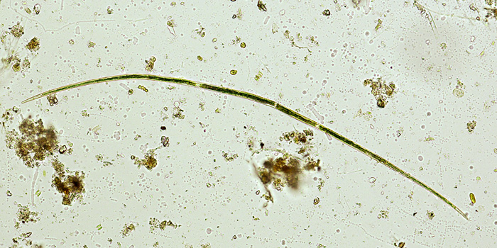 Closterium aciculare T. WEST, 1860 #69864