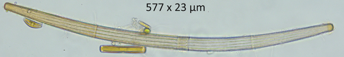 Closterium angustatum Ralfs var. angustatum #77196