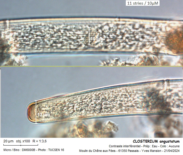 CLOSTERIUM angustatum #78835