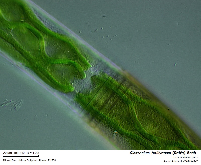 Closterium baillyanum (Ralfs) Bréb. #72120