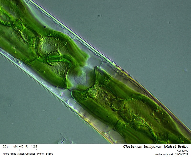 Closterium baillyanum (Ralfs) Bréb. #72119