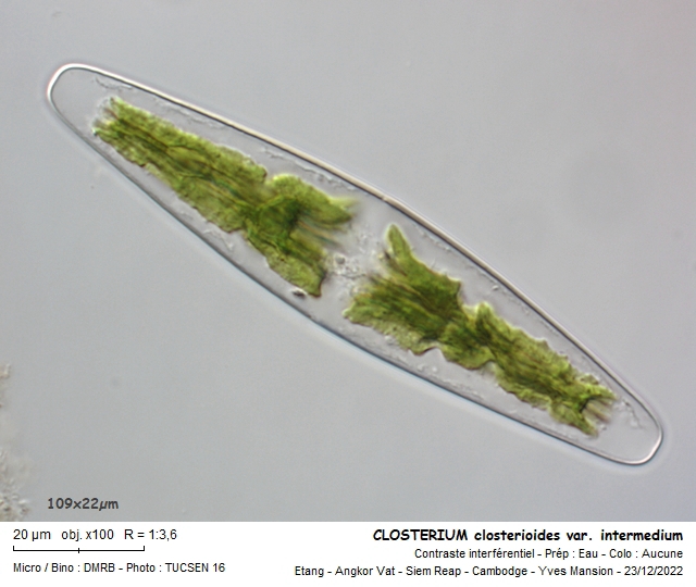 CLOSTERIUM closterioides #73209