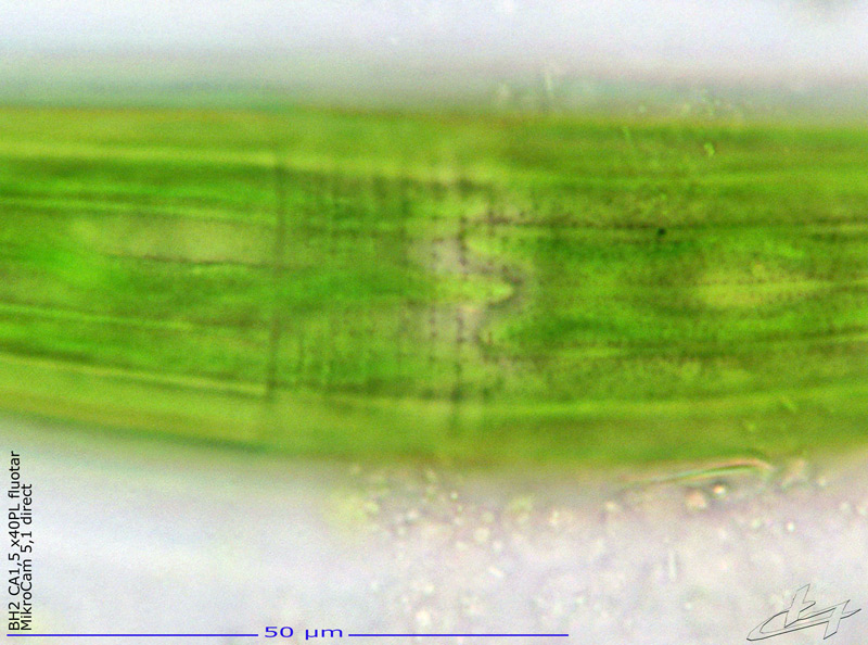 Closterium costatum Ralfs #69838