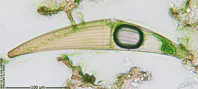 Closterium costatum Ralfs #69837
