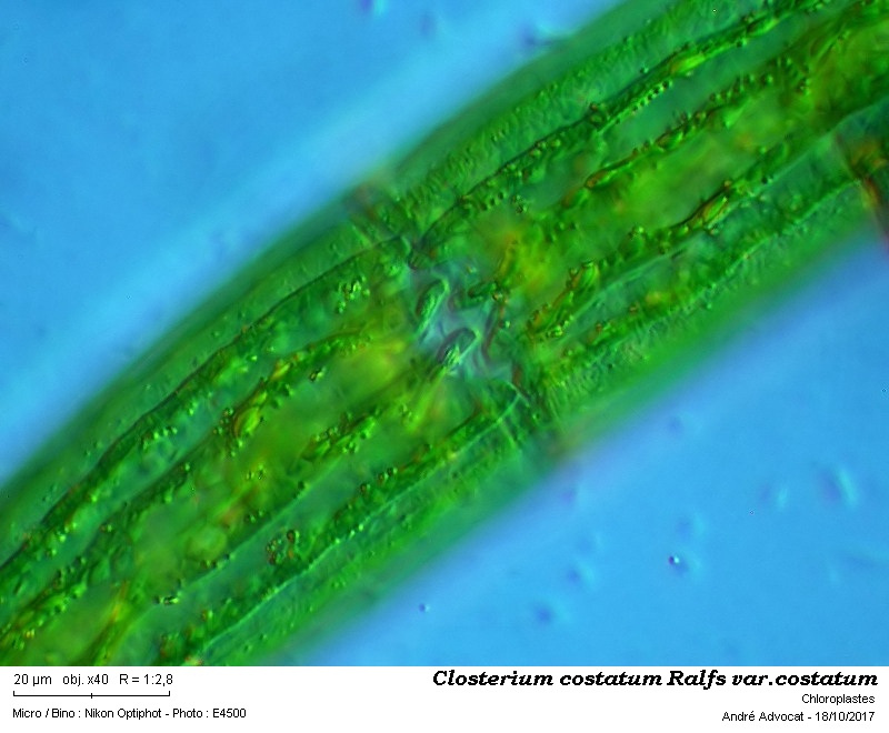 Closterium costatum Ralfs var.costatum #52860