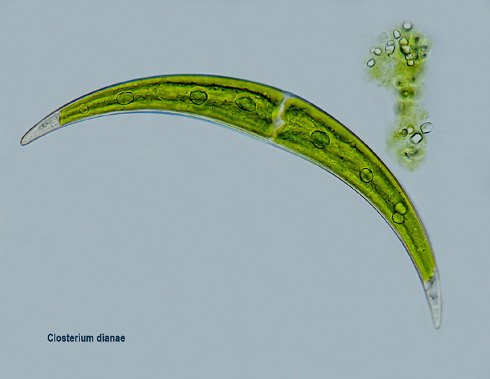 Closterium dianae #5911