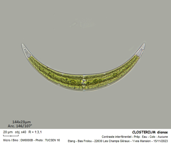 Closterium dianae Ehrenberg ex Ralfs #81938