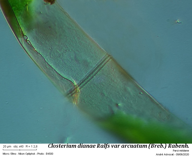 Closterium dianae Ralfs var. arcuatum (Breb.) Rabenh. #63758