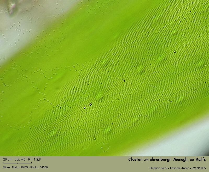Closterium ehrenbergii Menegh.ex Ralfs #2198