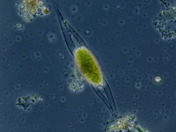 Closterium idiosporum W.& G.S.West #83602