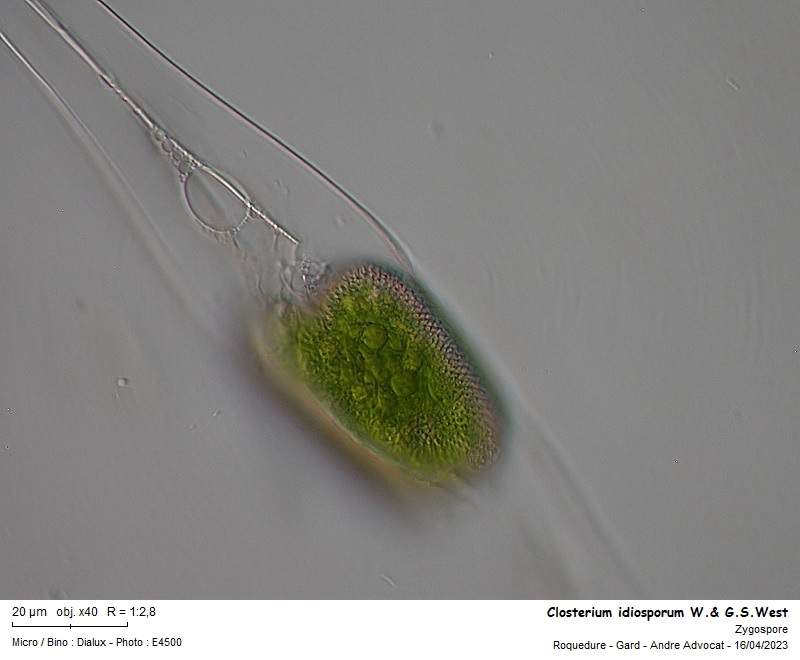 Closterium idiosporum W.& G.S.West #74195
