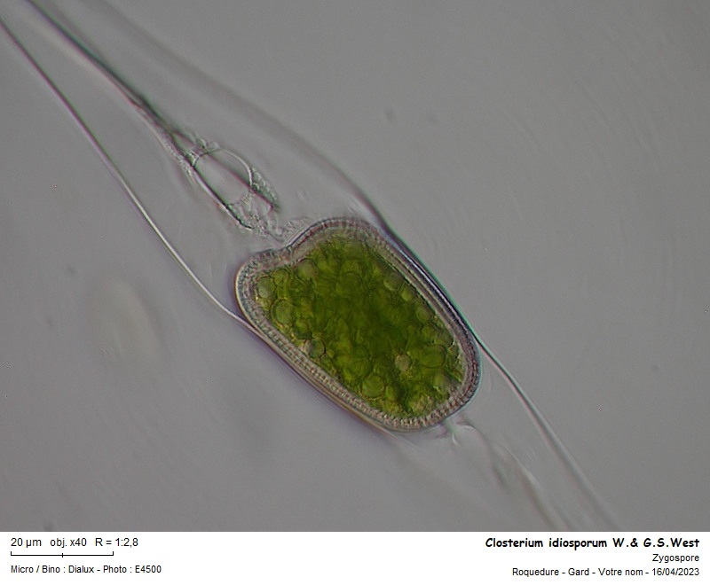 Closterium idiosporum W.& G.S.West #74193