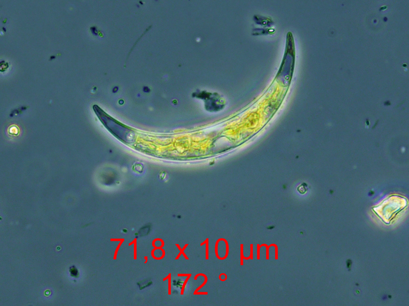 Closterium incurvum Brébisson, 1856 #65649