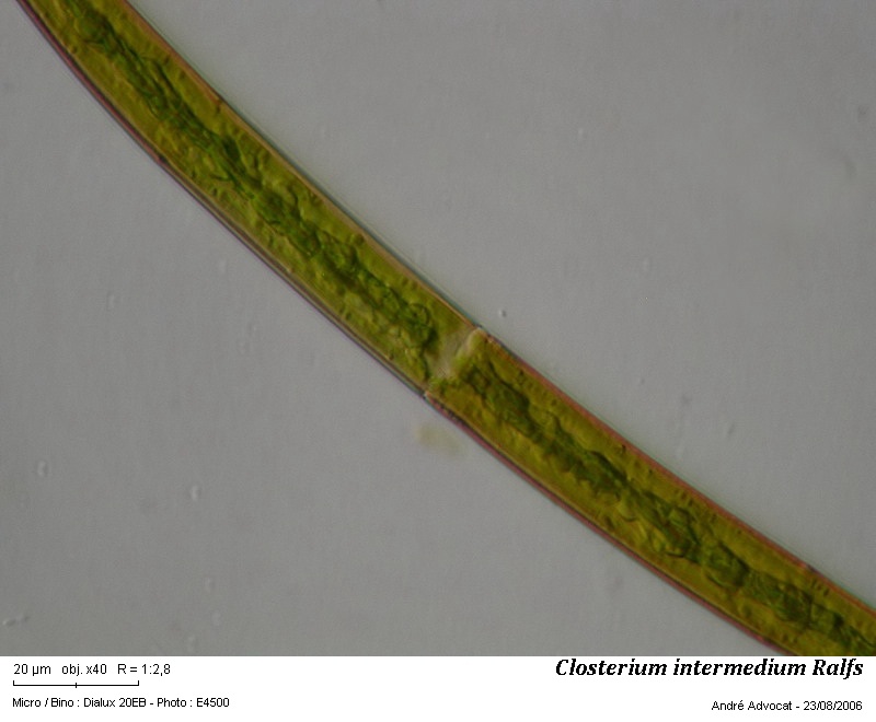 Closterium intermedium Ralfs #56279